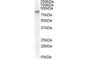 Western Blotting (WB) image for anti-Transient Receptor Potential Cation Channel, Subfamily V, Member 5 (TRPV5) (Internal Region) antibody (ABIN263199)