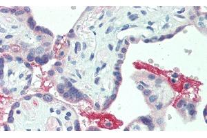 Detection of ECM1 in Human Placenta Tissue using Polyclonal Antibody to Extracellular Matrix Protein 1 (ECM1) (ECM1 抗体  (AA 20-434))