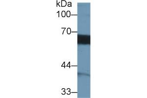 Detection of MMP3 in Human Hela cell lysate using Monoclonal Antibody to Matrix Metalloproteinase 3 (MMP3) (MMP3 抗体  (AA 363-477))