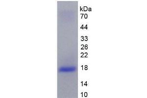 SDS-PAGE (SDS) image for Interleukin 10 Receptor, beta (IL10RB) (AA 87-243) (Active) protein (His tag) (ABIN6239818)