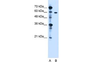 WB Suggested Anti-ZDHHC13 Antibody Titration:  1. (ZDHHC13 抗体  (N-Term))