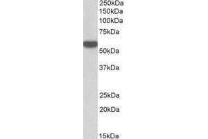 Western Blotting (WB) image for anti-Chromosome 22 Open Reading Frame 28 (C22orf28) (Internal Region) antibody (ABIN2464466) (C22orf28 抗体  (Internal Region))
