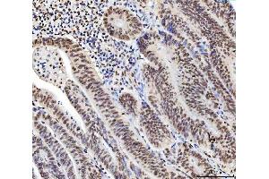 IHC analysis of C1orf77/FOP/CHTOP using anti-C1orf77/FOP/CHTOP antibody (ABIN7603201). (CHTOP 抗体  (N-Term))