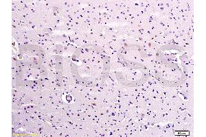Formalin-fixed and paraffin embedded rat brain labeled with Anti-Caspase-9 Polyclonal Antibody, Unconjugated (ABIN724175) 1:300 followed by conjugation to the secondary antibody and DAB staining (Caspase 9 抗体  (AA 271-314))