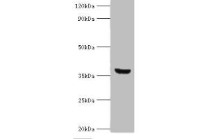 Western blot All lanes: ANXA8L2 antibody at 18 μg/mL + HepG2 whole cell lysate Secondary Goat polyclonal to rabbit IgG at 1/10000 dilution Predicted band size: 37, 31 kDa Observed band size: 37 kDa (ANXA8L2 抗体  (AA 1-276))