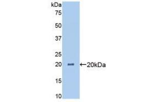 Western blot analysis of recombinant Pig ANGPTL4. (ANGPTL4 抗体  (AA 227-389))
