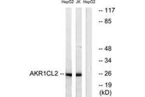 Western Blotting (WB) image for anti-Aldo-Keto Reductase Family 1, Member E2 (AKR1E2) (AA 141-190) antibody (ABIN2890107) (AKR1E2 抗体  (AA 141-190))