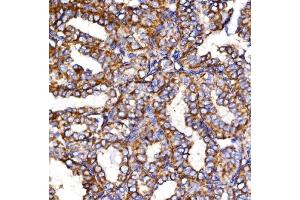 IHC analysis of MDH2 using anti-MDH2 antibody (ABIN7602618).