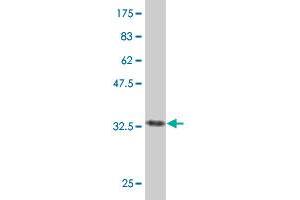 Western Blotting (WB) image for anti-Prostaglandin I2 (Prostacyclin) Synthase (PTGIS) (AA 391-500) antibody (ABIN562513)