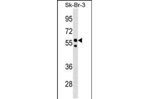Western blot analysis in SK-BR-3 cell line lysates (35ug/lane). (FBXO31 抗体  (AA 310-338))