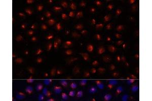 Immunofluorescence analysis of HeLa cells using ACTN3 Polyclonal Antibody at dilution of 1:100 (40x lens). (ACTN3 抗体)
