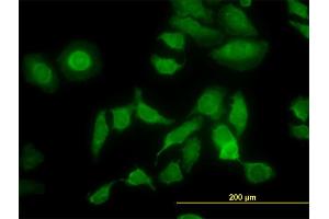 Immunofluorescence of monoclonal antibody to PDIA5 on HeLa cell. (PDIA5 抗体  (AA 31-130))