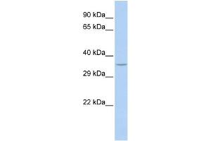 WB Suggested Anti-SPDYA Antibody Titration: 0. (SPDYA 抗体  (N-Term))