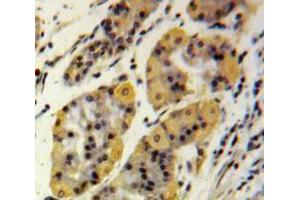 IHC-P analysis of Stomach tissue, with DAB staining. (MMP2 抗体  (AA 110-660))