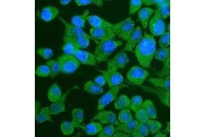 IF analysis of YTHDF2 using anti-YTHDF2 antibody (ABIN7603191). (YTHDF2 抗体  (N-Term))