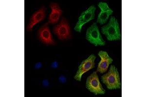 ABIN6264030 and ABIN6277904 staining HepG2 cells by IF/ICC.