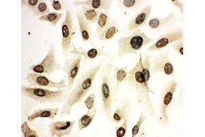 ICC testing of HeLa cells