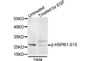 Western blot analysis of extracts of various cell lines, using Phospho-HSPB1-S15 antibody. (HSP27 抗体  (pSer15))