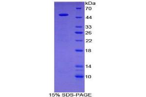 SDS-PAGE analysis of Human GAL3ST1 Protein. (GAL3ST1 蛋白)