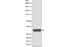 Western blot analysis of Galectin 3 expression in MCF-7 cell lysate.