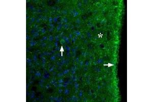 Expression of MC3R in rat brainImmunohistochemical staining of perfusion-fixed frozen rat brain sections using Anti-MC3 Receptor (extracellular) Antibody (ABIN7043323 and ABIN7044595), (1:100). (Melanocortin 3 Receptor (MC3R) Peptide)