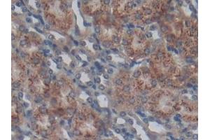 Immunohistochemistry (IHC) image for anti-Sprouty Homolog 1, Antagonist of FGF Signaling (SPRY1) (AA 112-303) antibody (ABIN7439549)