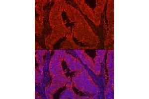 Immunofluorescence analysis of human colon carcinoma using LG Rabbit pAb (ABIN7268200) at dilution of 1:100 (40x lens). (Galectin 2 抗体  (AA 1-132))