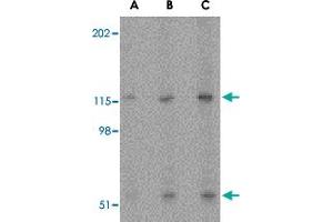 Western blot analysis of PRSS12 in SK-N-SH cell lysate with PRSS12 polyclonal antibody  at (A) 0. (Neurotrypsin 抗体  (N-Term))