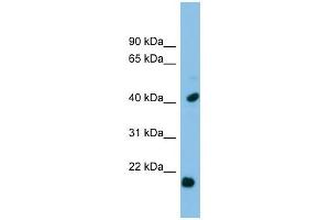 HSPB2 antibody used at 1 ug/ml to detect target protein. (HSPB2 抗体  (Middle Region))