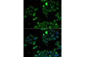 Immunofluorescence analysis of U2OS cell using UQCRFS1 antibody. (UQCRFS1 抗体)