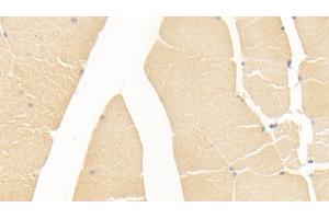 Immunohistochemistry (IHC) image for anti-Alanine Aminotransferase (ALT) (AA 255-492) antibody (ABIN7425764)