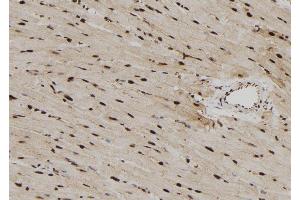 ABIN6279782 at 1/100 staining Rat heart tissue by IHC-P. (RPS6KL1 抗体  (Internal Region))