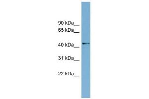 AMDHD1 antibody used at 1 ug/ml to detect target protein. (AMDHD1 抗体  (N-Term))