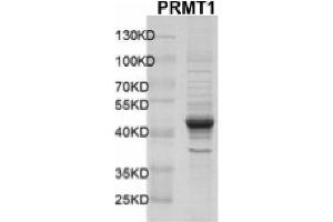 PRMT1 Protein (DYKDDDDK Tag)