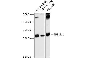 Western blot analysis of extracts of various cell lines, using TREML1 antibody (ABIN6129498, ABIN6149484, ABIN6149485 and ABIN6214659) at 1:1000 dilution. (TREML1 抗体  (AA 16-162))