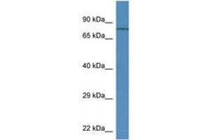 Image no. 1 for anti-Transient Receptor Potential Cation Channel, Subfamily V, Member 6 (TRPV6) (AA 280-329) antibody (ABIN6746125)