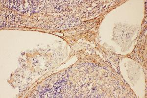 Anti-C5/C5a antibody, IHC(P) IHC(P): Rat Spleen Tissue (C5 抗体  (N-Term))