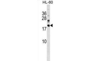 Western Blotting (WB) image for anti-DnaJ (Hsp40) Homolog, Subfamily C, Member 30 (DNAJC30) antibody (ABIN5019514) (DNAJC30 抗体)