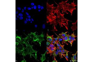 Immunocytochemistry/Immunofluorescence analysis using Mouse Anti-GFAP R416WT Monoclonal Antibody, Clone S206B-9 . (GFAP 抗体  (AA 411-422) (PerCP))