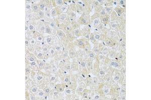 Immunohistochemistry of paraffin-embedded rat liver using SLC4 antibody (ABIN6132890, ABIN6148015, ABIN6148016 and ABIN6214688) at dilution of 1:100 (40x lens). (NBC4 抗体  (AA 1042-1121))