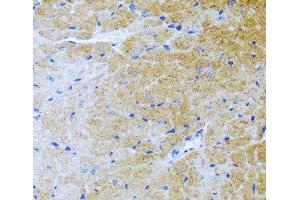 Immunohistochemistry of paraffin-embedded Mouse heart using BMP3 Polyclonal Antibody at dilution of 1:100 (40x lens). (BMP3 抗体)