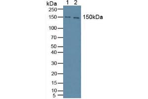 Western blot analysis of (1) Mouse Brain Tissue and (2) Human HeLa cells. (Phospholipase C gamma 1 抗体  (AA 1091-1290))