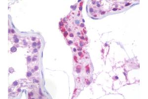 Human Testis: Formalin-Fixed, Paraffin-Embedded (FFPE)