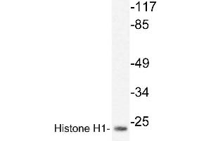 Western blot (WB) analyzes of Histone H1oo antibody in extracts from HUVEC cells. (Histone H1 抗体)