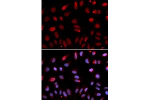 Immunofluorescence (IF) image for anti-HUS1 Checkpoint Homolog (S. Pombe) (HUS1) antibody (ABIN1876595) (HUS1 抗体)