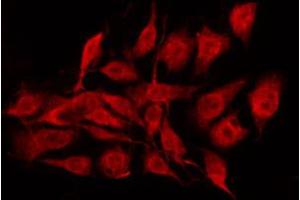 ABIN6267352 staining MCF7 by IF/ICC. (Bcl-2 抗体  (pSer70))