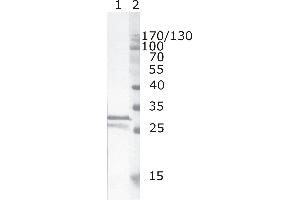 Western Blot testing of HIV-1 recombinant Nef protein. (HIV-1 Nef (AA 35-50) 抗体)