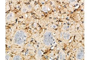 ABIN6263536 and ABIN6277080 at 1/100 staining Mouse brain tissue by IHC-P.