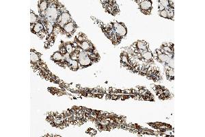 IHC analysis of Rex1/ZFP42 using anti-Rex1/ZFP42 antibody (ABIN7600901).