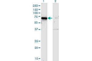 Western Blot analysis of TSPYL1 expression in transfected 293T cell line by TSPYL1 monoclonal antibody (M01), clone 4F11. (TSPYL1 抗体  (AA 1-100))